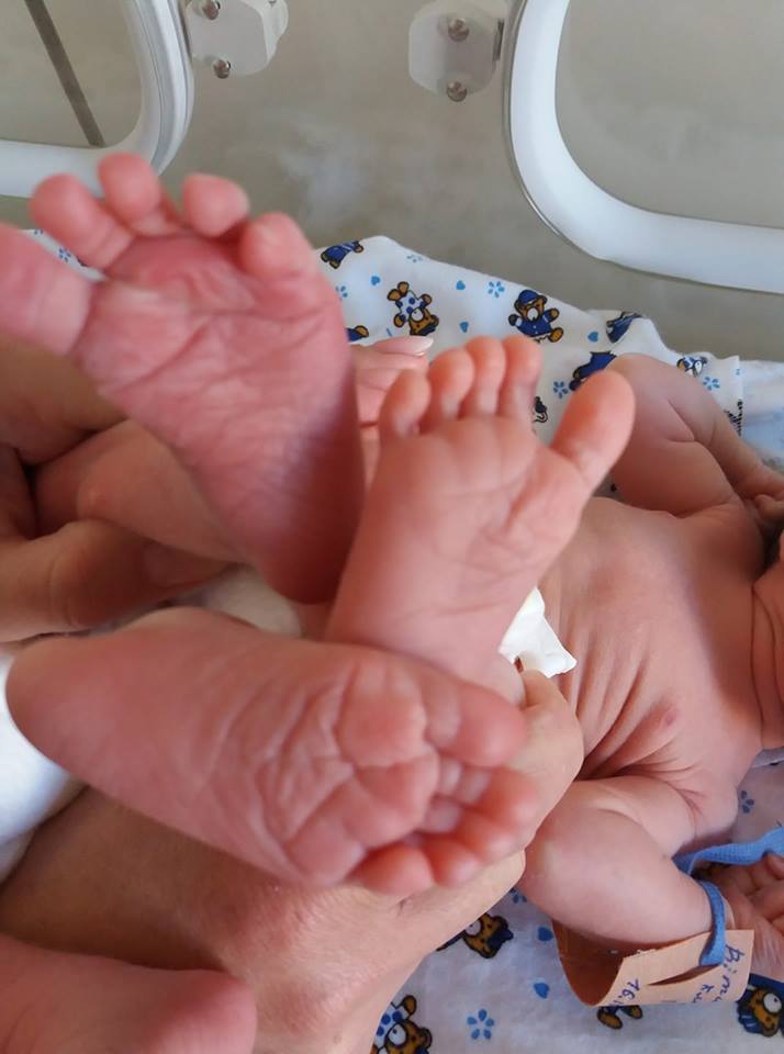 Перша трійня перинатального