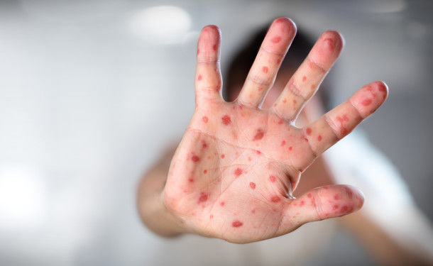 У Польщу заборонять в’їзд іноземцям без щеплень