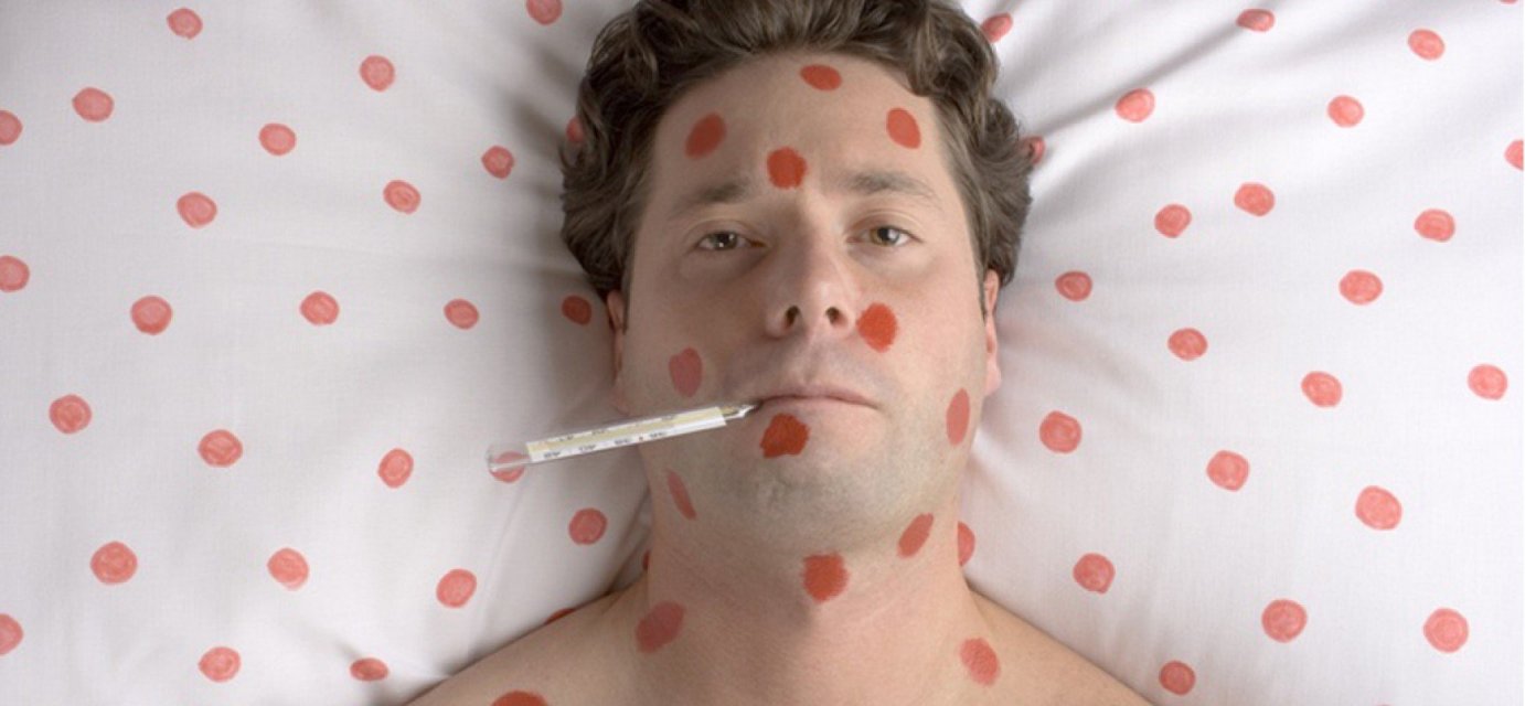 На Львівщину завезли вакцину від кору