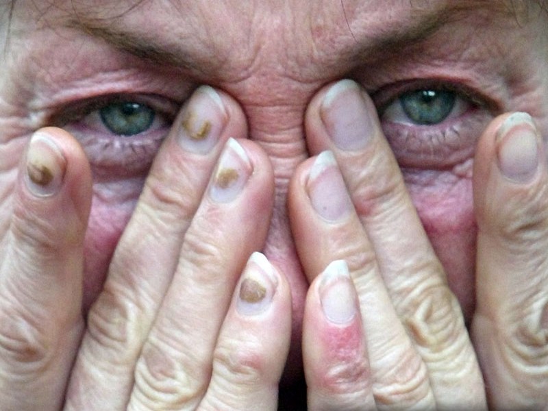 Сп’янілий від наркотиків син мало не замордував батьків