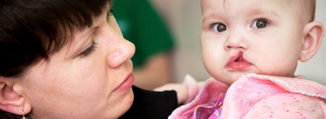 Американські хірурги в Україні оперуватимуть дітей з “заячою губою”