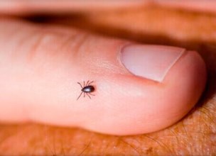 27 мешканців Львівщини цього року потерпіли від кліщів