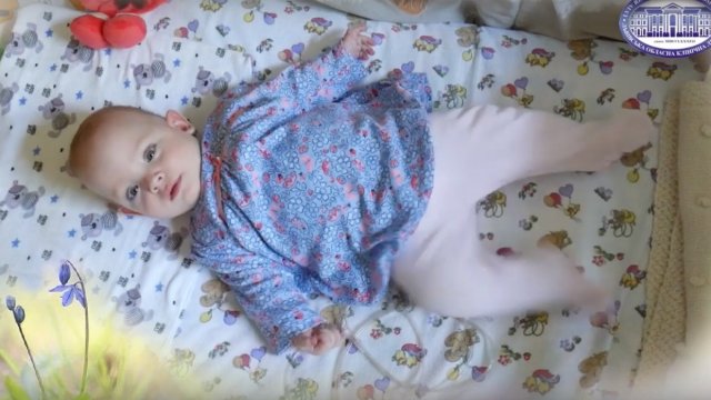 Рік львівські неонатологи виходжували 480-грамову дівчинку