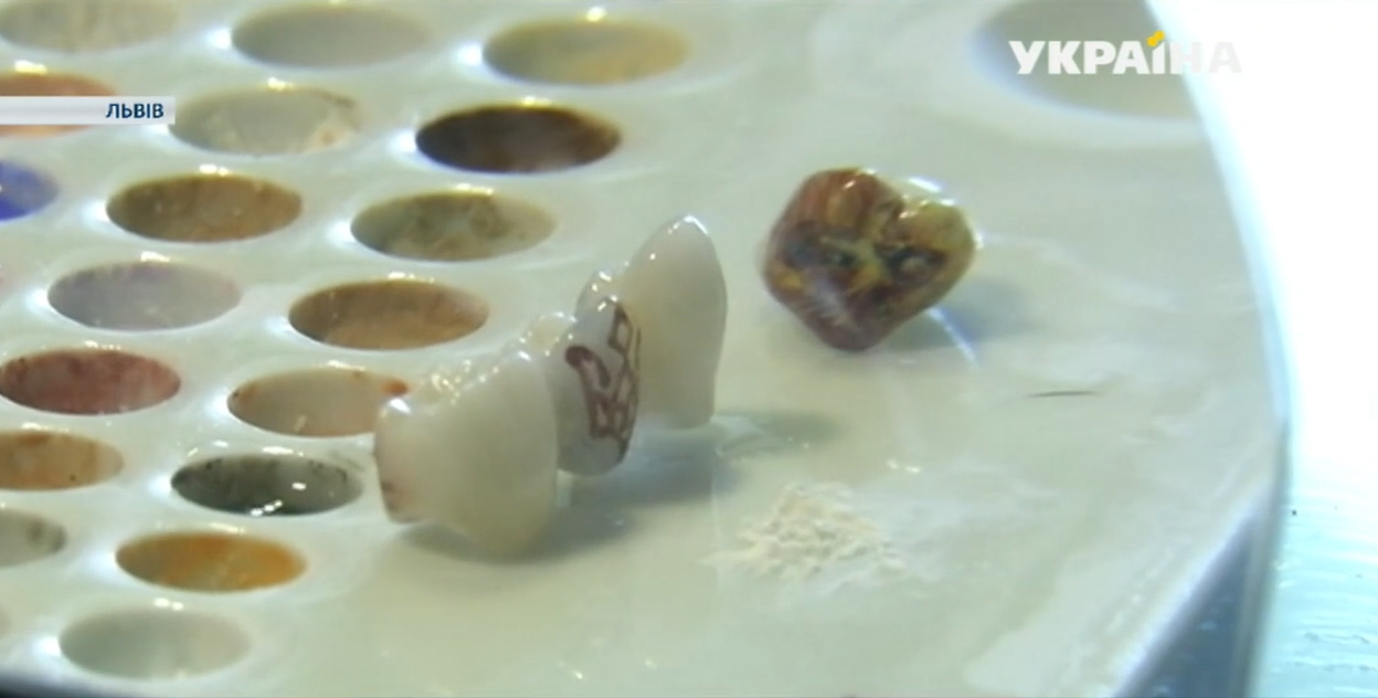 Львівський зубний технік малює картини у роті