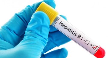 У Львові безкоштовно тестуватимуть на гепатити