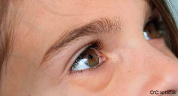 «Обов’язково дізнайтеся причину набряків під очима», – лікар Анастасія Марко