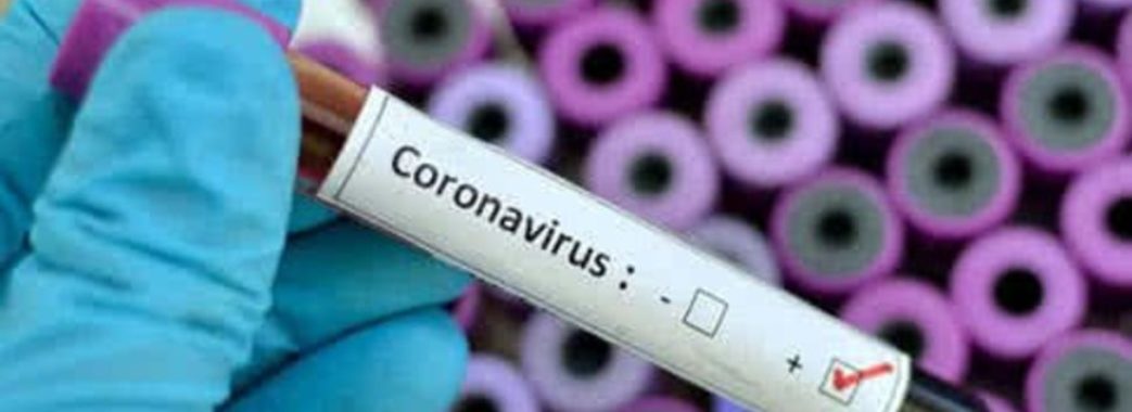 «Новина збентежила, але паніки нема»: у селі на Жовківщині, де гостювала хвора на коронавірус, усі здорові