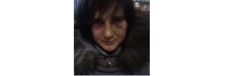 Били та ґвалтували: у Перемишлянах познущались над сиротою