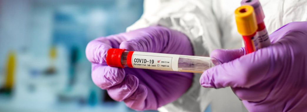 Коли буде пік епідемії коронавірусу в Україні: Шмигаль назвав нові дати