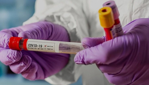 На Львівщині перша смерть від коронавірусу: пацієнта підключали до апарату ШВЛ