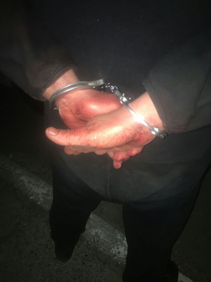 Ножем у груди: у Винниках чоловік зарізав брата