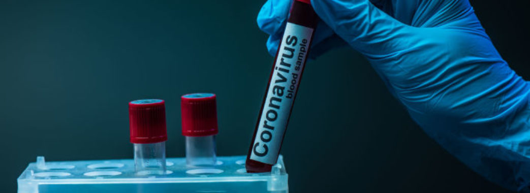 Стало відомо, де виявили нові випадки коронавірусу на Львівщині