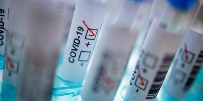 Львівщина знову лідирує за кількістю нових хворих на COVID-19: де виявили недужих цієї доби