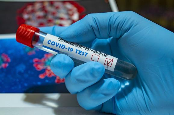 COVID-19 підтвердили ще у 171 мешканця Львівщини: звідки хворі