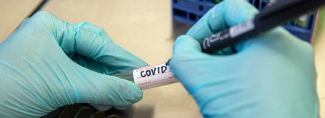 На Львівщині за добу 188 нових випадків Covid-19: звідки хворі