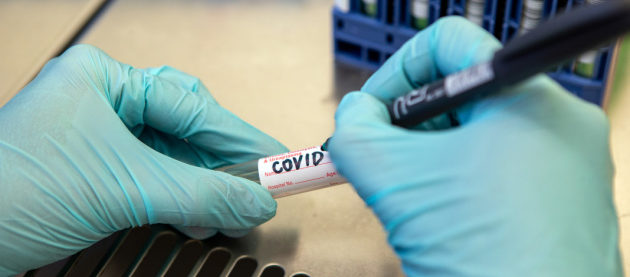 На Львівщині за добу 188 нових випадків Covid-19: звідки хворі
