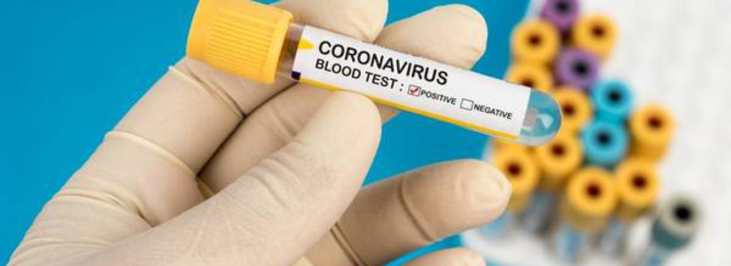 В Україні анонсували появу нових безкоштовних експрес-тестів на коронавірус