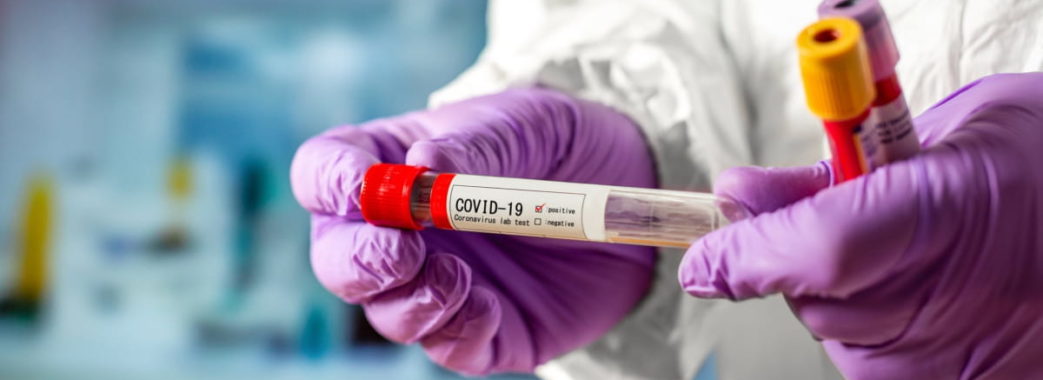 За останню добу на Львівщині від COVID-19 померли 14 людей: де фіксували нові спалахи хвороби