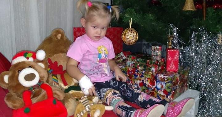 «Не зможу дивитися, як згасає Меланія»: 3-річна дівчинка з Радехівщині бореться зі страшною недугою