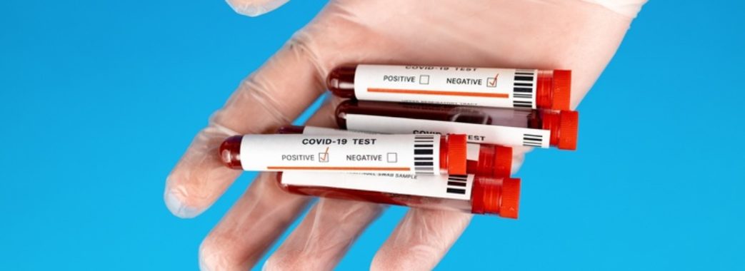 Менше тестувань, менше випадків: оновлені дані коронавірусу на Львівщині та в Україні