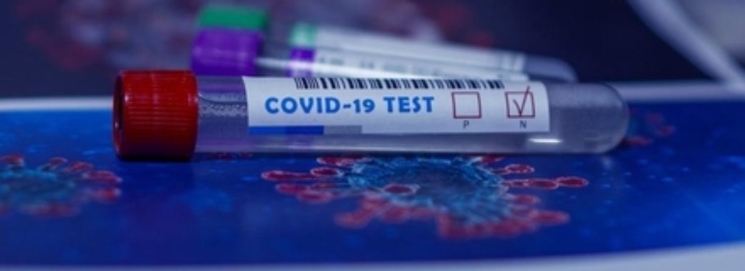 Лише 146 ПЛР-тестів цієї доби показали негативний результат: коронавірусна статистика на Львівщині