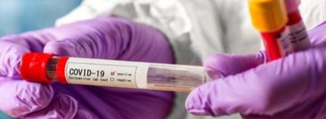 Більше тисячі мешканців Львівщини намагаються побороти коронавірус у лікарнях: свіжа ковід-статистика