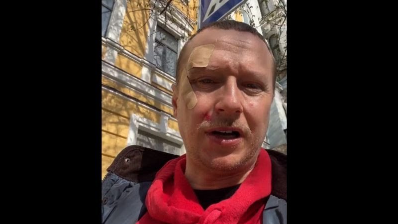 Популярного телеведучого зі Львова вдарили через зауваження