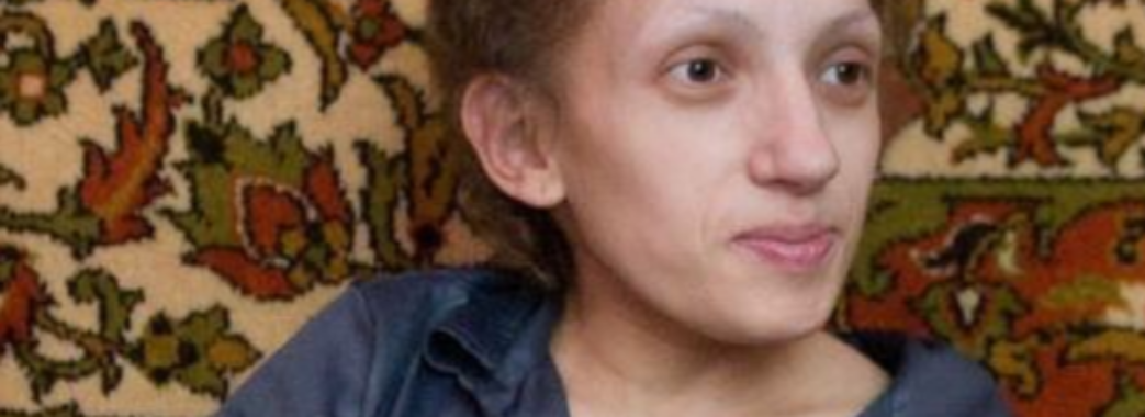 Сама виховує 10-річну доньку: найнижча мама України з Червонограда бореться з онкологією