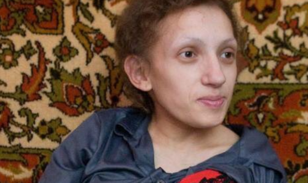 Сама виховує 10-річну доньку: найнижча мама України з Червонограда бореться з онкологією