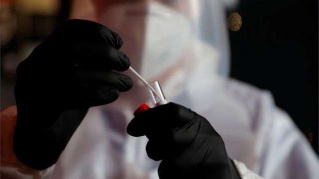 На Львівщині більше 300 хворих на коронавірус за добу: статистика