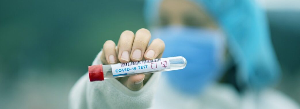 На Львівщині виявили майже 400 нових випадків коронавірусу