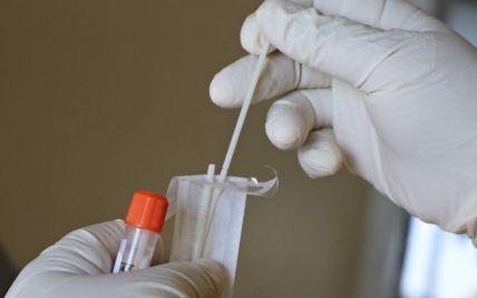 На Львівщині виявили більше 400 нових випадків коронавірусу