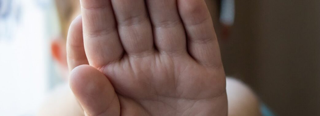 Ледь не залишилась без пальчиків: львівські медики врятували ручку 4-річній дівчинці