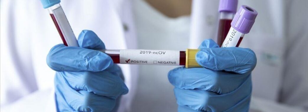 Коронавірус: на Львівщині за останню добу близько 300 нових випадків захворювання