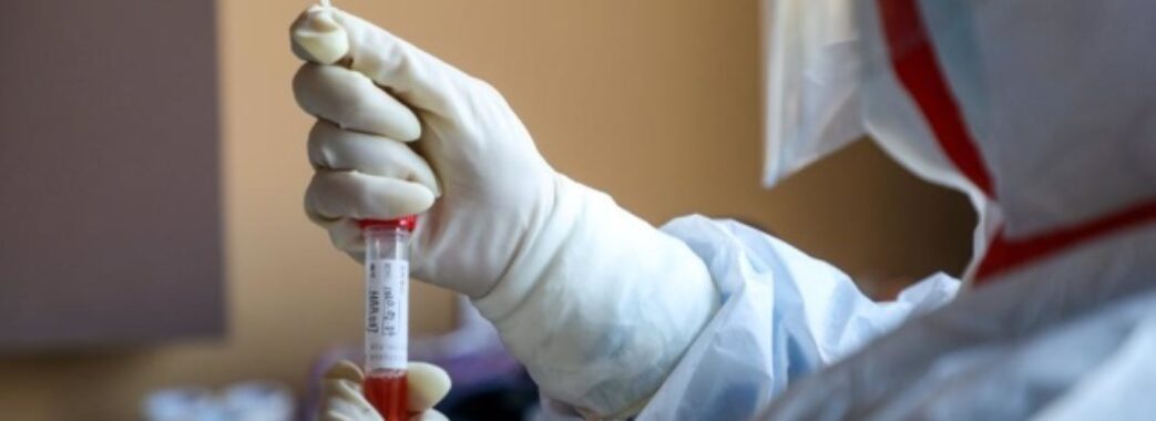 Коронавірус йде на спад: за останню добу недугу підхопили 85 людей