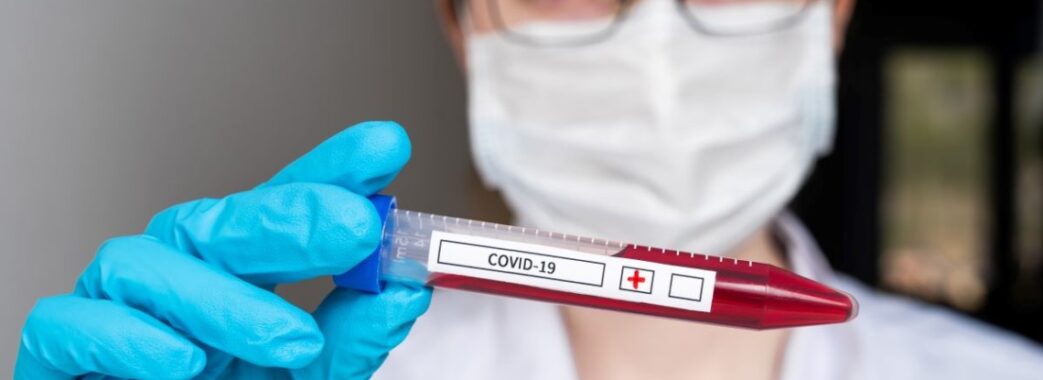 Коронавірус: на Львівщині за останню добу хворобу підчепили 400 людей