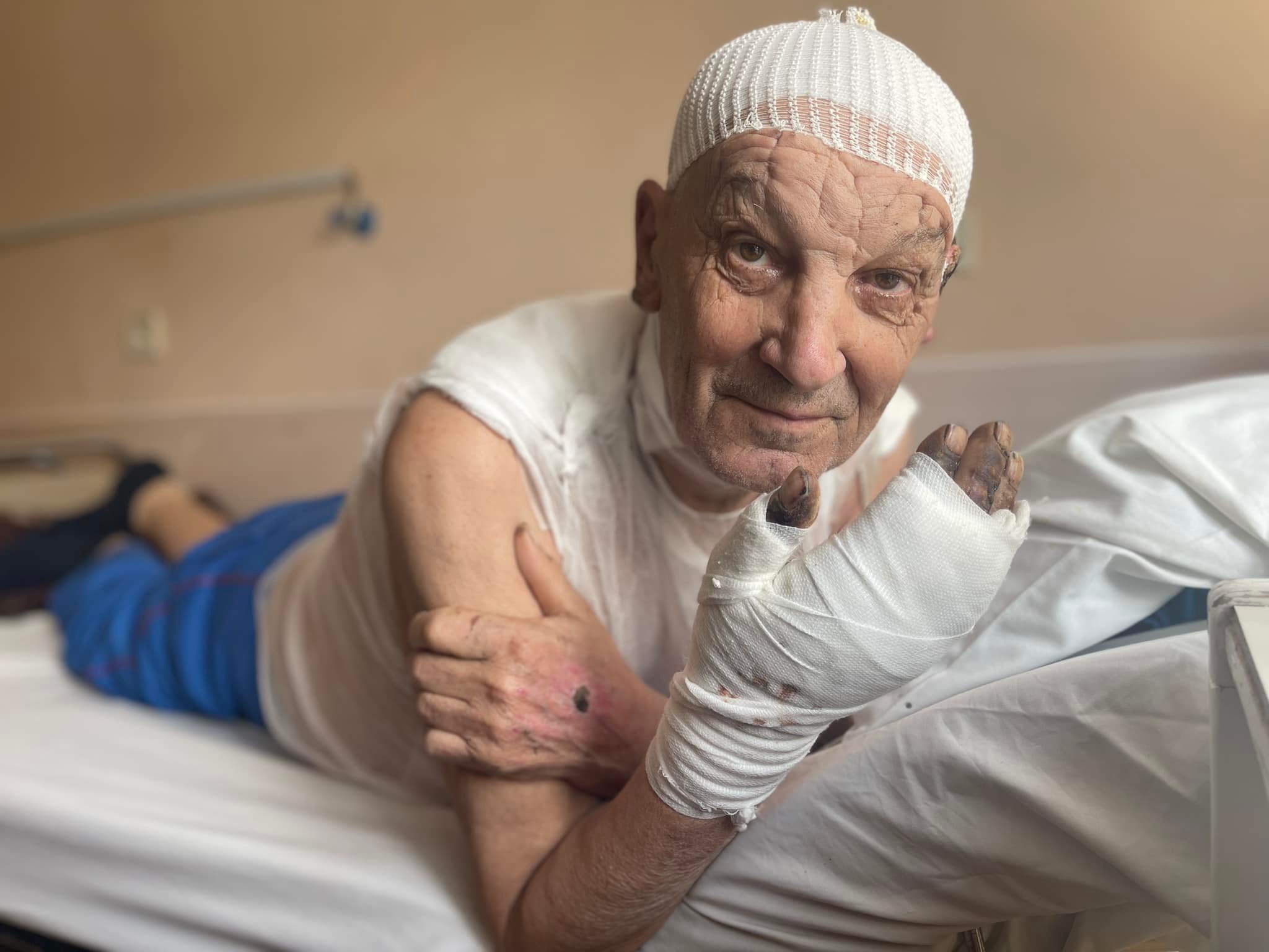 Одяг горів просто на ньому: у Львові прооперували чоловіка з Попасної