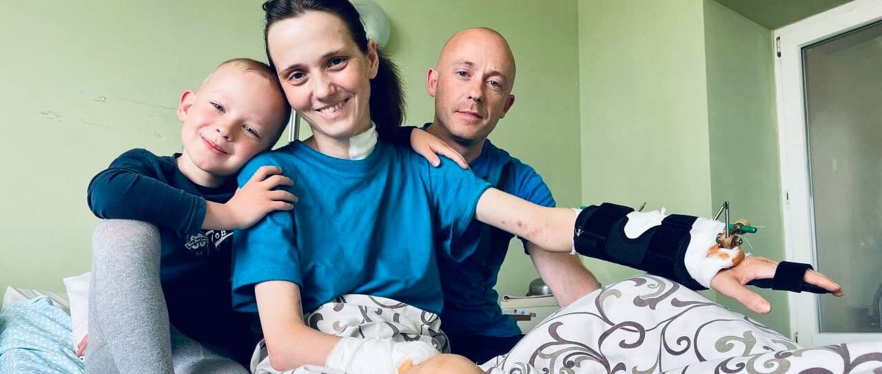 Втратила руку, ногу та ненароджену дитину: львівські медики допомогли важкопораненій жительці Лиману