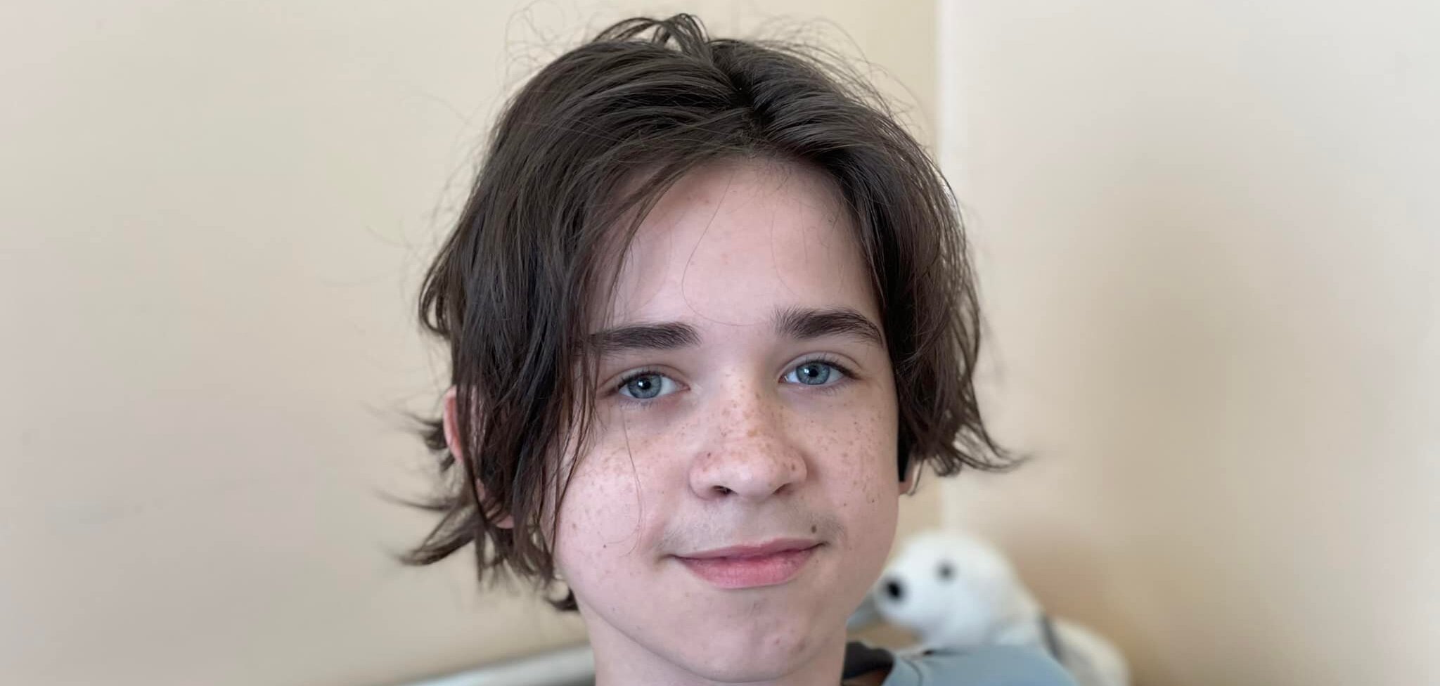 У Львові поставили на ноги хлопця, якого важко поранило під час обстрілу вокзалу в Краматорську