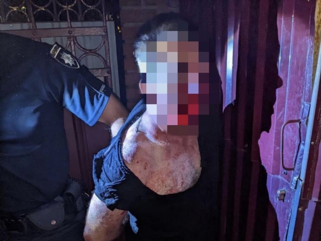 Під час бійки у Львові загинув іноземець