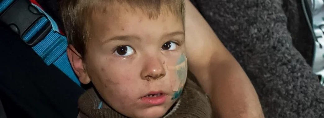 995 дітей постраждали від вторгнення рф в Україну, – Офіс Генпрокурора
