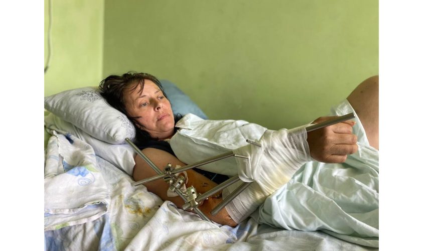 Засипало землею: львівські медики рятують жінку з Бахмута