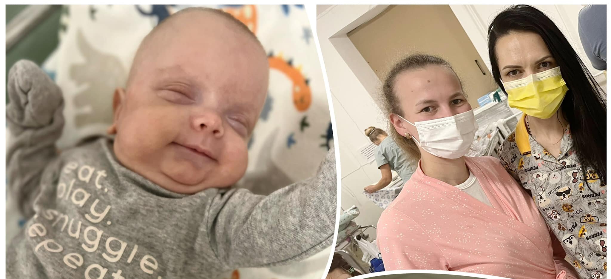 Львівські офтальмологи врятували зір передчасно народженому немовляті