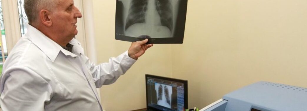 У Львові запрацювала виїзна послуга рентген-обстеження: для кого і скільки коштує