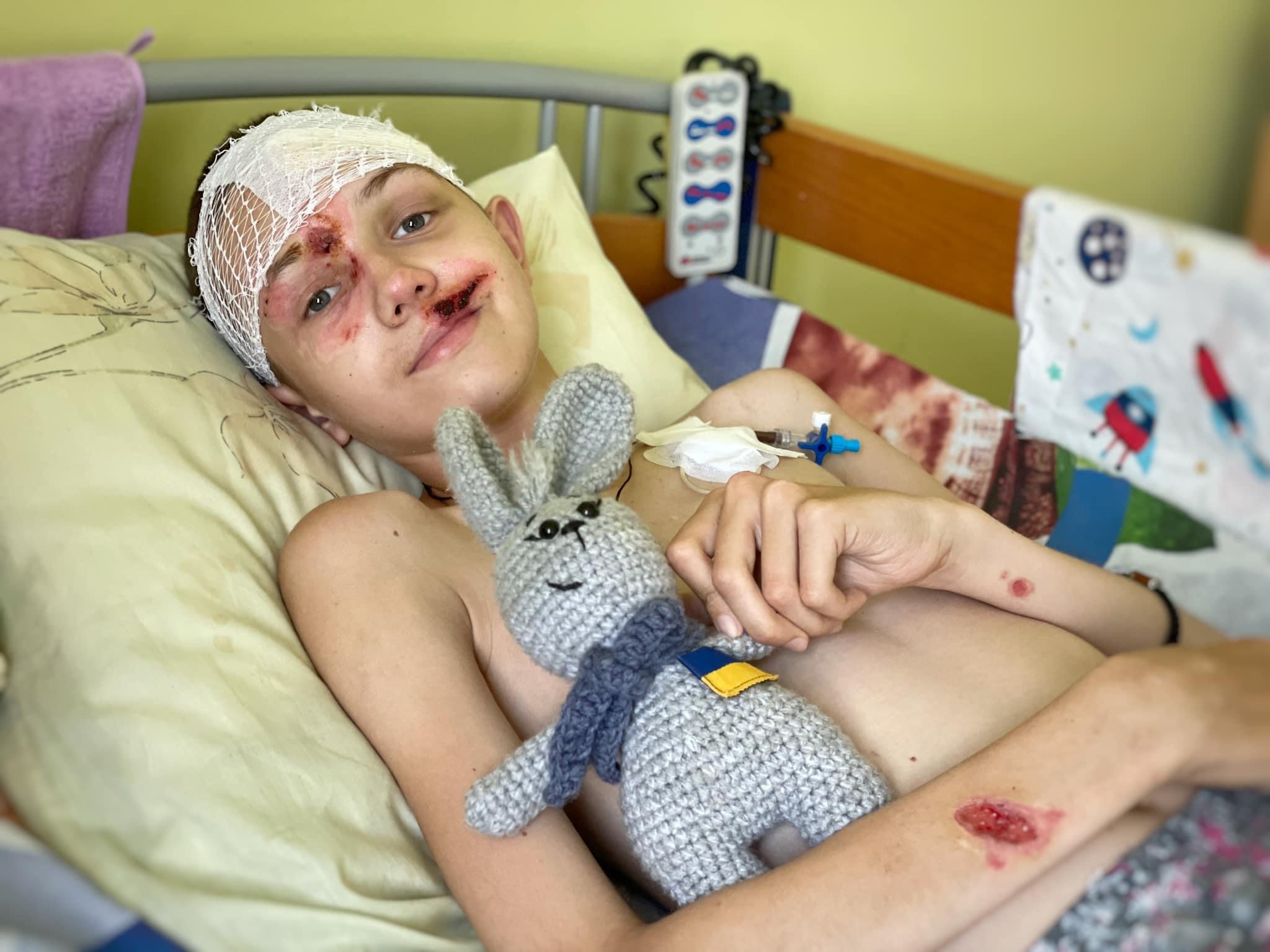 У Львові прооперували 12-річного хлопчика, якому уламок ракети потрапив в голову