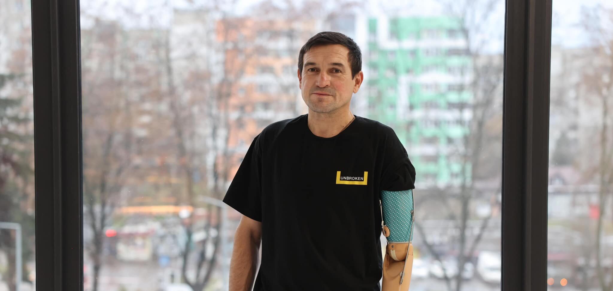У Львові медики встановили протез руки воїну, який був на «Азовсталі» та у полоні в «Оленівці»