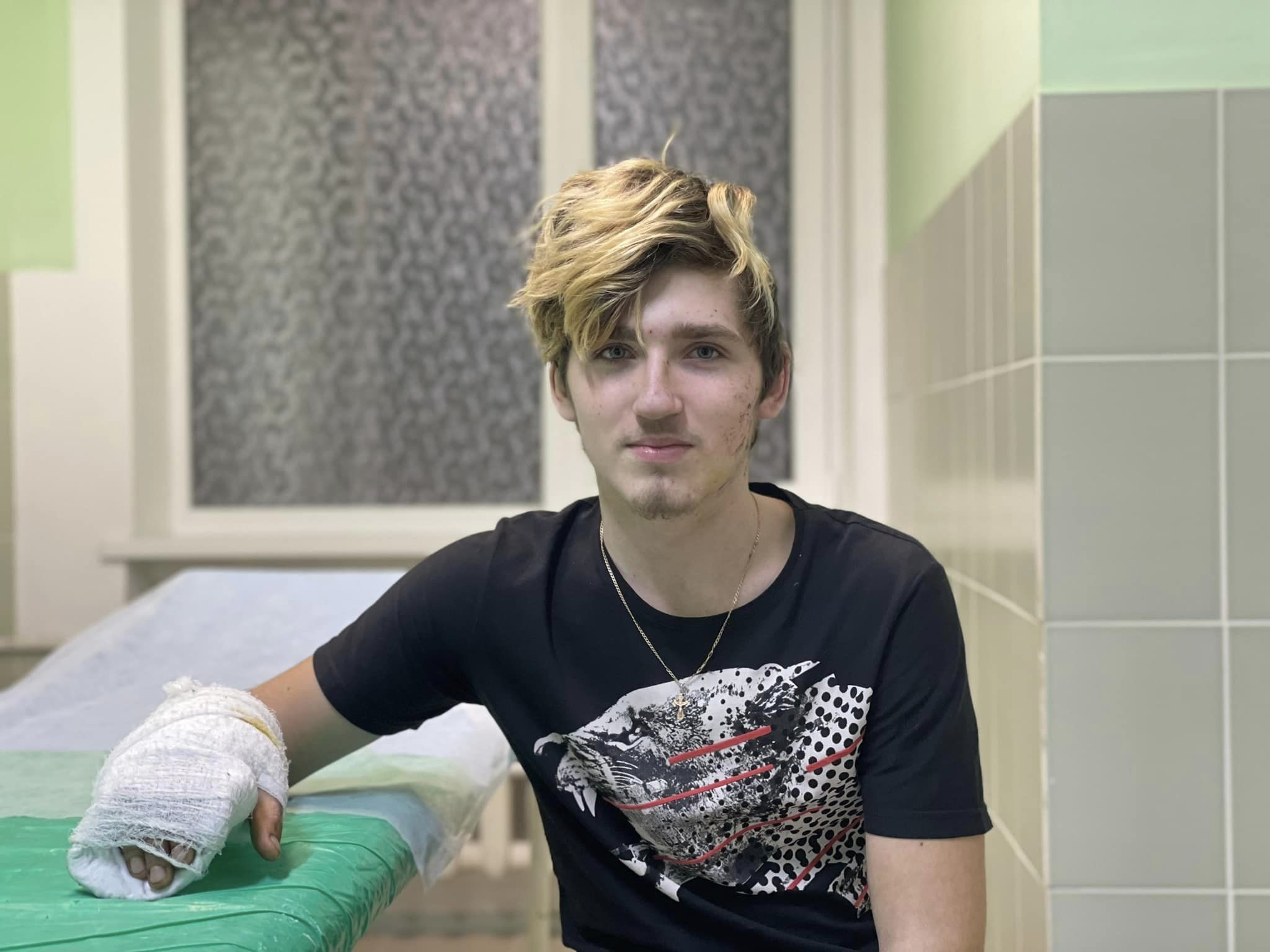 Попри поранення самотужки вибрався з-під завалів: у Львові лікують підлітка з Бахмута