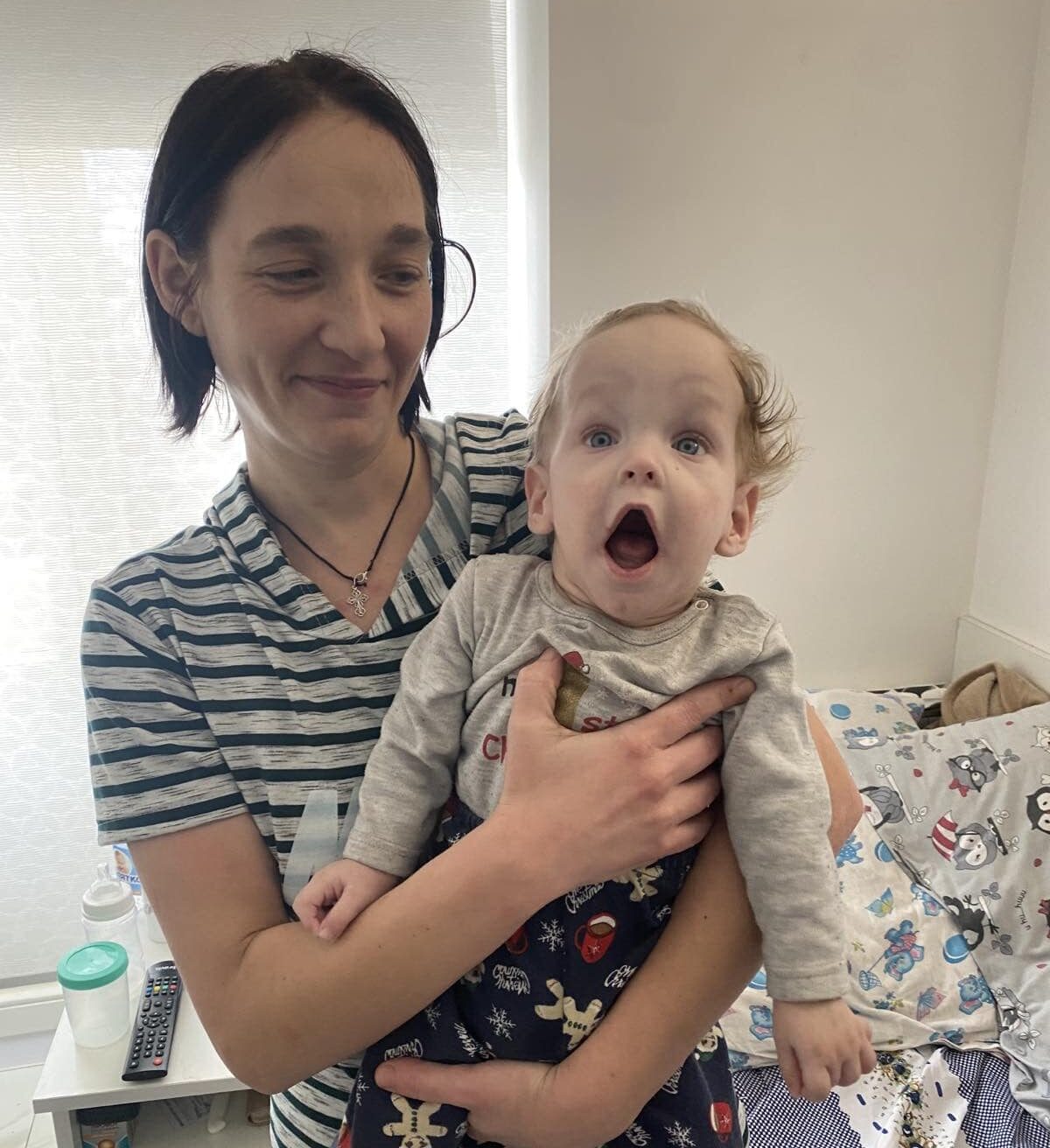 У Львові медики прооперували хлопчика із рідкісним синдромом Денді-Уокера