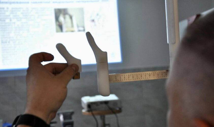 Буде більш стабільний: спеціалісти центру НЕЗЛАМНІ вивчили нову техніку протезування