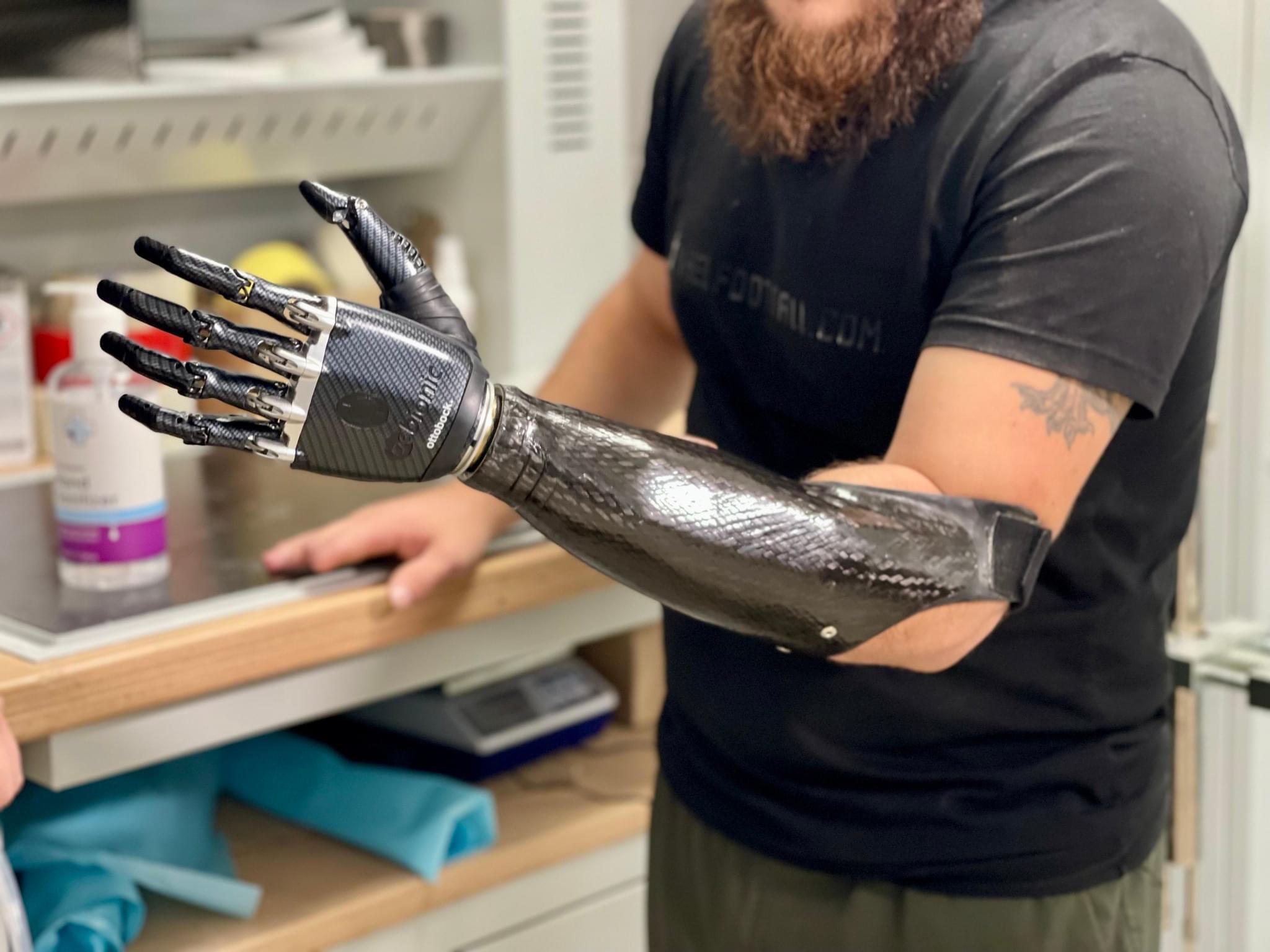 Бійцю з Маріуполя встановили біонічний протез